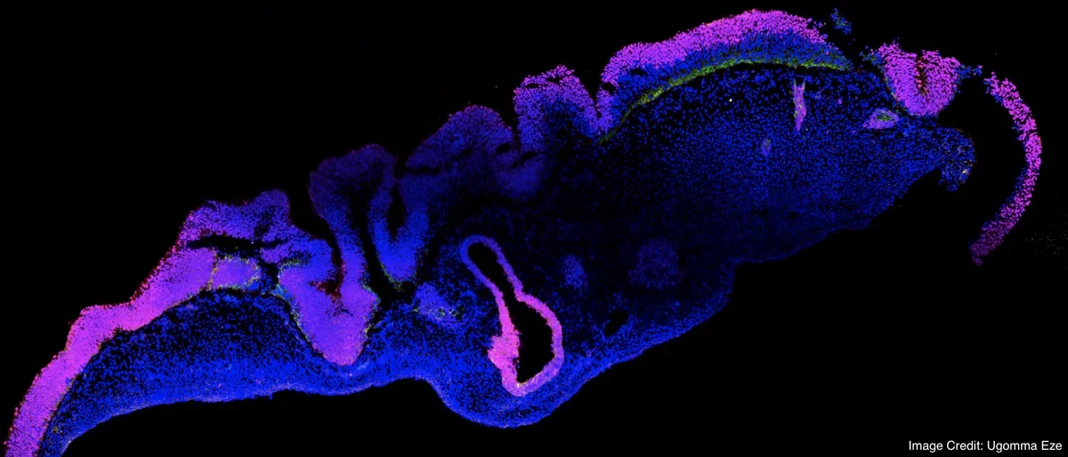 An immunostained image of a cortical organoid derived from human stem cells.