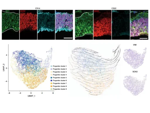 NE_EzeBhaduri_fig2ab