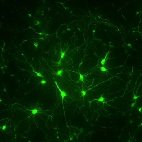 Astrocytes