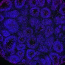 meta_dapi_rosette