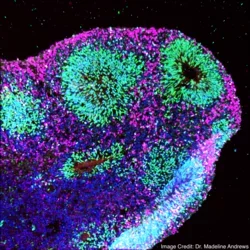 An immunostained image of a human cortical organoid.
