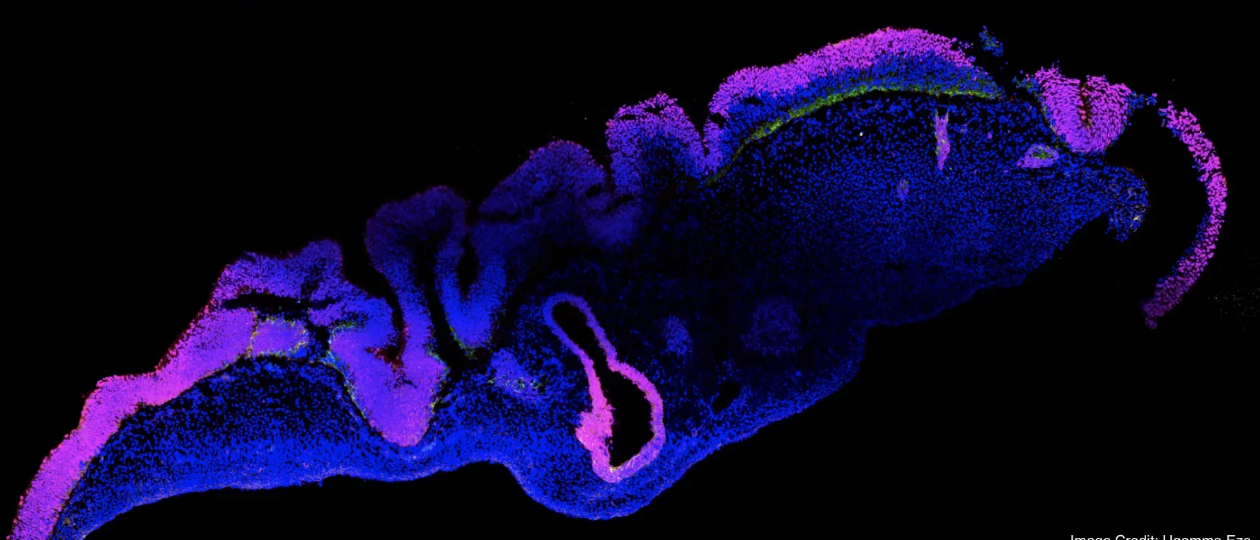 An immunostained image of a cortical organoid derived from human stem cells.